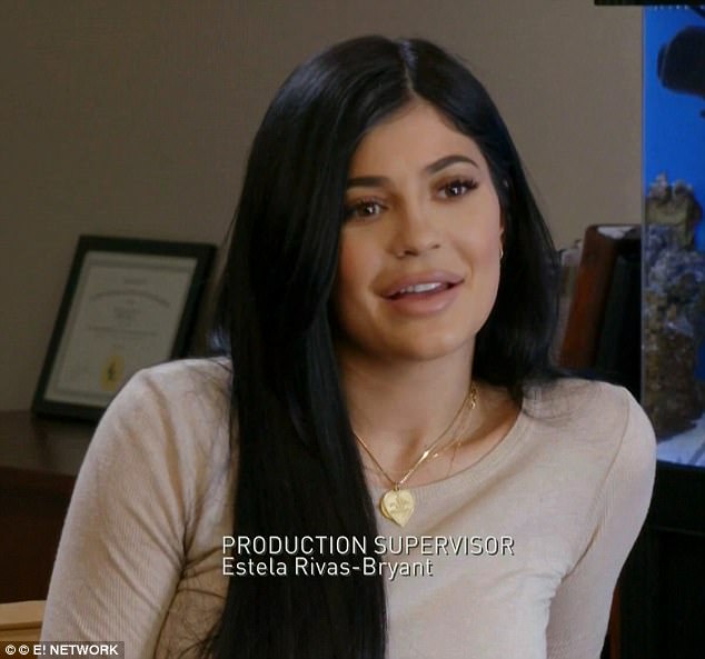 Kylie Jenner inainte de operatia de marire a buzelor
