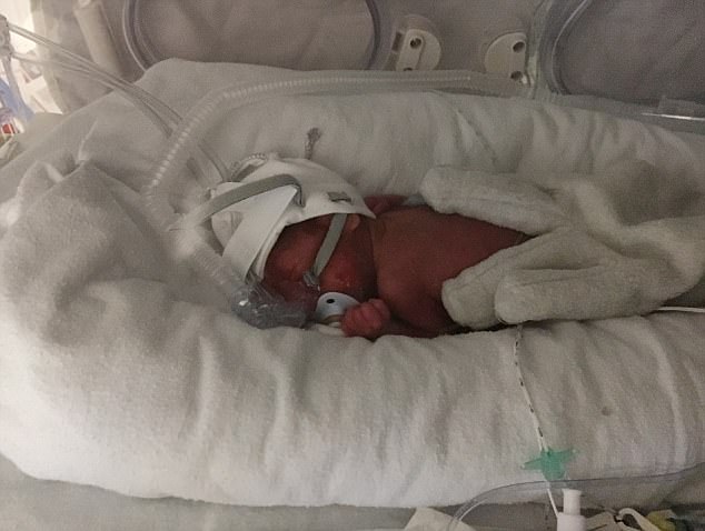 Bebelus nascut prematur, la 23 de saptamani