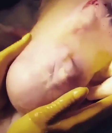 Bebelus nascut cu tot cu sacul amniotic! Imagini rare in lume