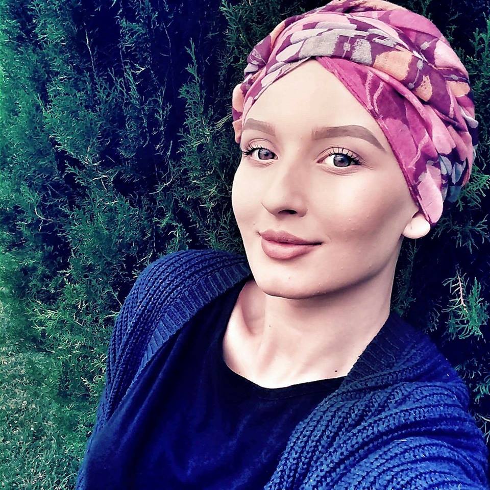 Denisse Mainea alopecia