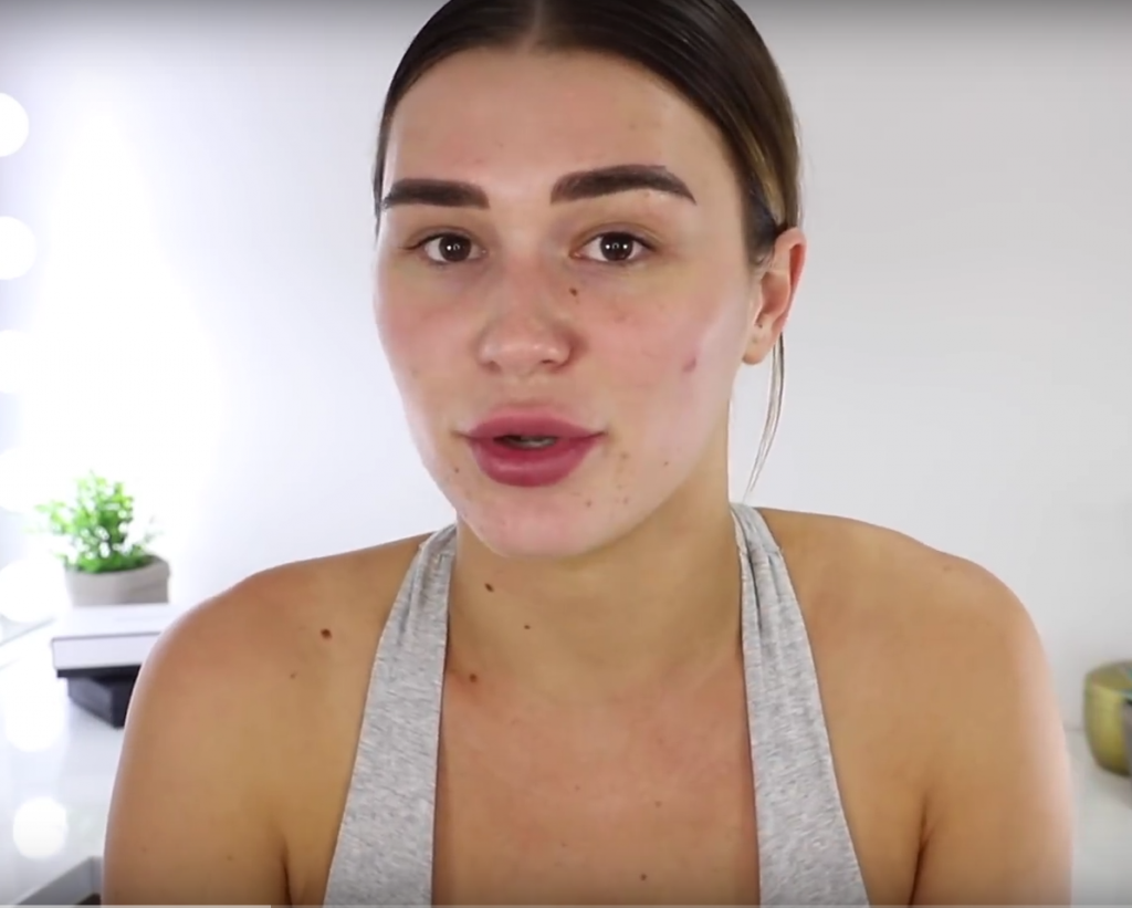 Bloggerita asta le-a aratat femeilor cum pot scapa de acnee in doar 5 minute