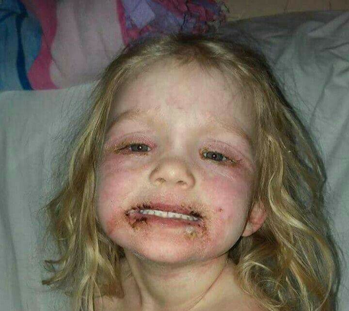 Fata de 3 ani, de urgenta la spital din cauza mamei sale!