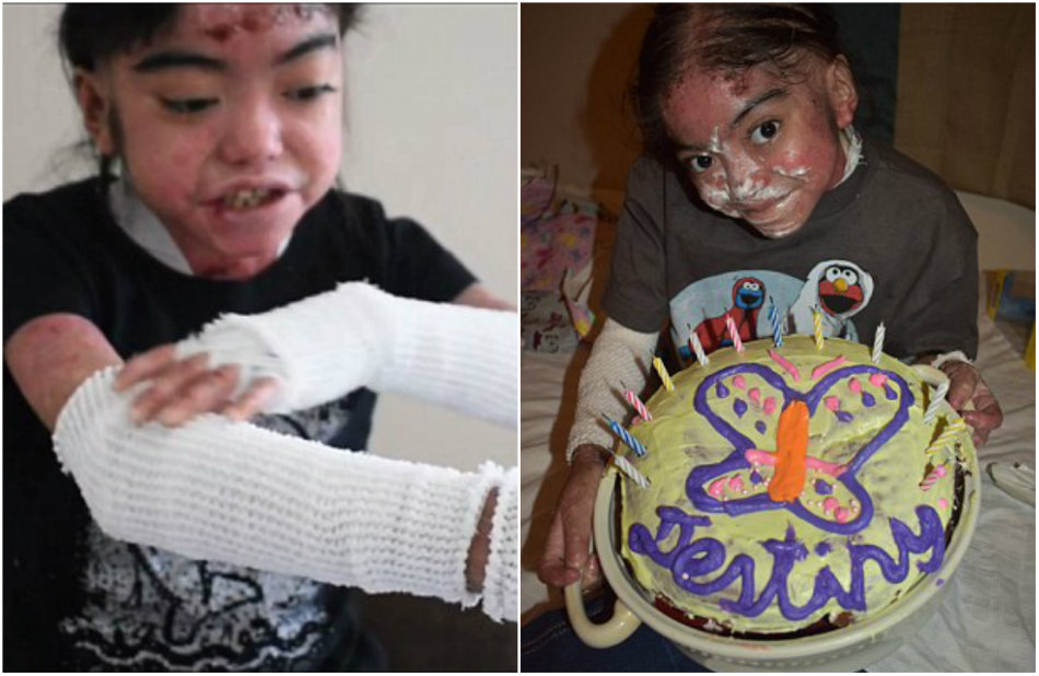 Fetita de 12 ani se lupta zilnic cu o boala grava