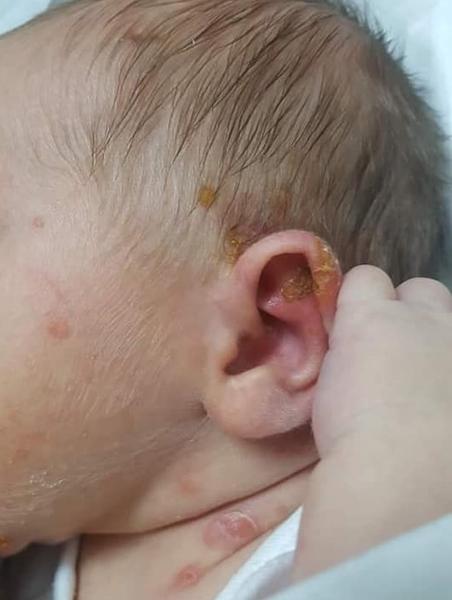 Groaznic! Un bebelus de o saptamana, internat din cauza infectiilor luate din spital. Parintii sunt distrusi: 