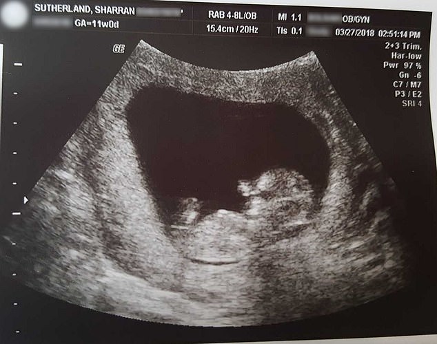 Cum arata un fetus la 14 saptamani. E FORMAT complet!