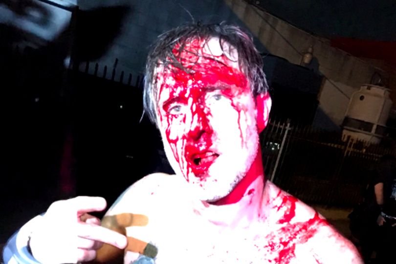 David Arquette, batut la wrestling. A ajuns la spital, la un pas de moarte VIDEO