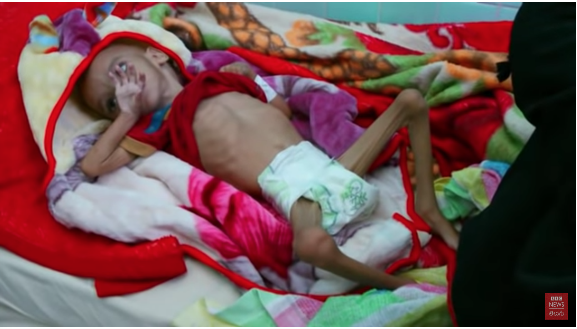 Imagini Crunte Din Yemen Tara Unde Milioane De Copii Traiesc Doar