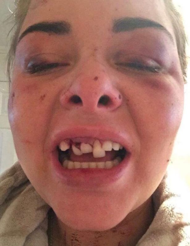 Cruzime fara margini: si-a mutilat iubita din cauza unei fotografii de pe Facebook