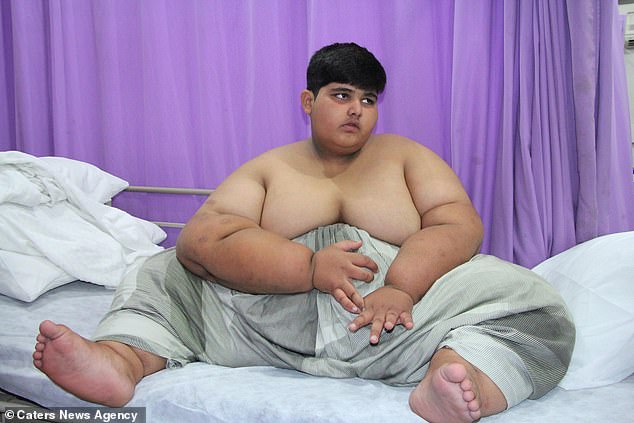 Cel mai gras copil din lume e in PERICOL! Cate kg are!