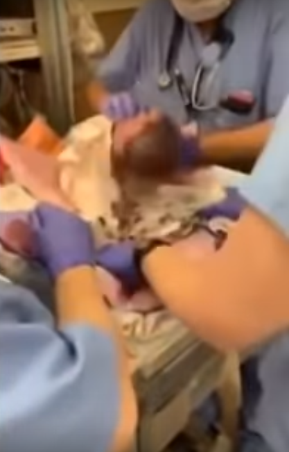 Un medic a scapat un bebelus in cap