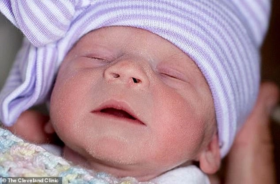 Bebelus nascut dupa un transplant de uter, provenit de la o femeie decedata