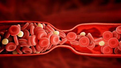 Cum poate grupa de sânge să-ți afecteze sănătatea. Bolile pe care le riști în funcție de grupa de sânge