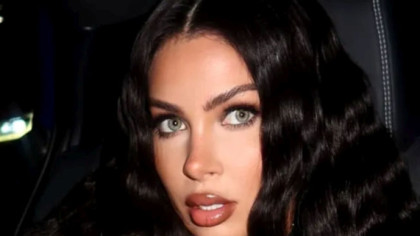 Influencerița celebră care a vrut să arate ca „Barbie” și a fost la un pas de moarte. Implantul din fesieri i-a explodat! Cât s-a chinuit bruneta